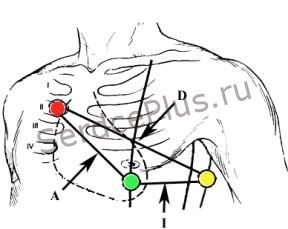 "<yoastmark