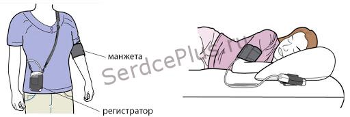 Показания к проведению СМАД