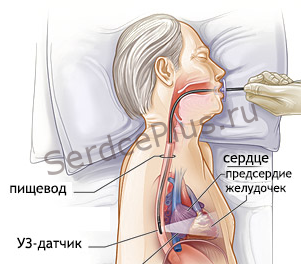Открытое овальное окно