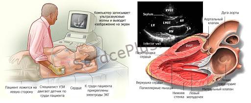 ЭхоКГ/Эхокардиография