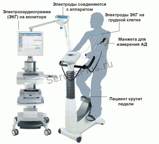 Велоэргометрия